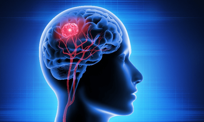 Cross-Post: We need more than brain injury awareness: We need new treatment